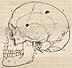 Book Art • Trepanning in old anatomy book